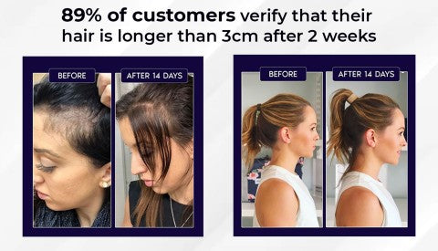 HZA™ Natuurlijke Haargroei Spray