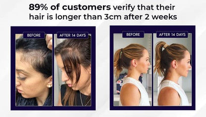 HZA™ Natuurlijke Haargroei Spray