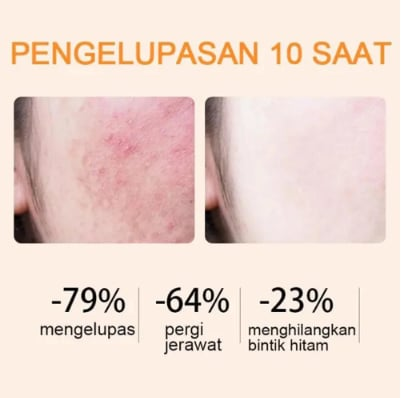 🍊 BBOJI™ Orange Enzyme Exfoliating Gel — De zachte huidmirakel waar jouw gezicht op heeft gewacht