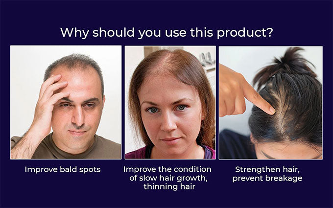 HZA™ Natuurlijke Haargroei Spray