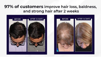 HZA™ Natuurlijke Haargroei Spray