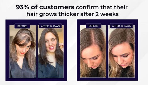 HZA™ Natuurlijke Haargroei Spray